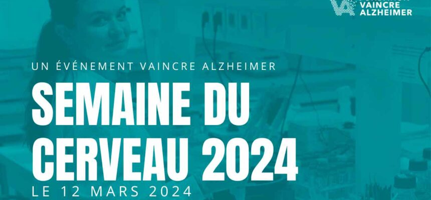 Semaine du cerveau 2024 : Venez visiter le laboratoire d’une chercheuse que vous avez financée !